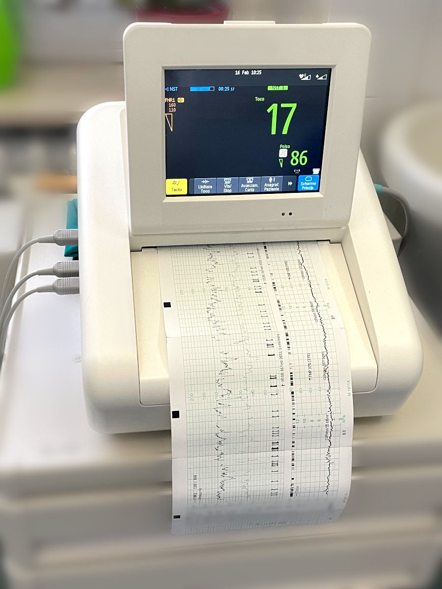 Cardiotocograph (CTG)